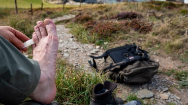blisters